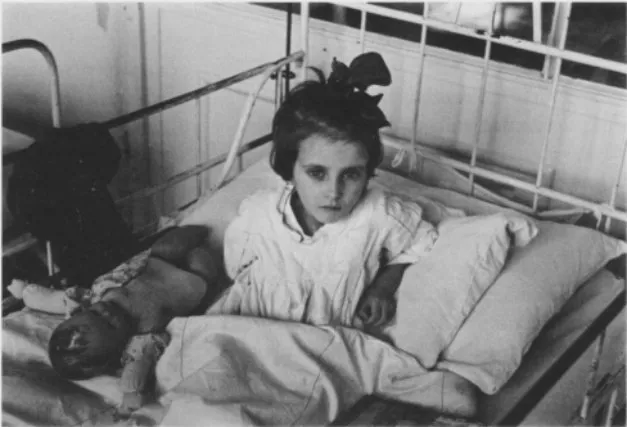 Black-and-white photograph of a young girl with a large bow in her hair, sitting up in a white-railed hospital bed and looking at the camera; a worn doll lies on the bed beside her.