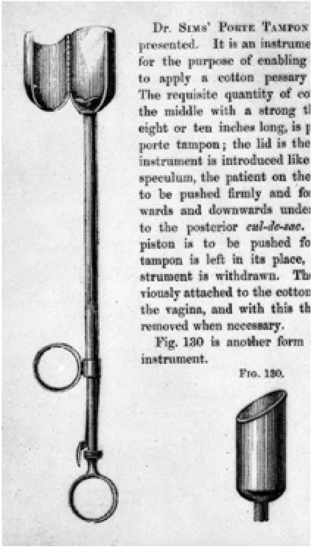 Part of a page from a nineteenth-century medical textbook. An engraving shows a long-handled instrument with two finger rings and a cup-shaped end, beside a cropped column of text headed “Dr. Sims’ Porte Tampon”; a smaller engraving below is labelled “Fig. 130”.